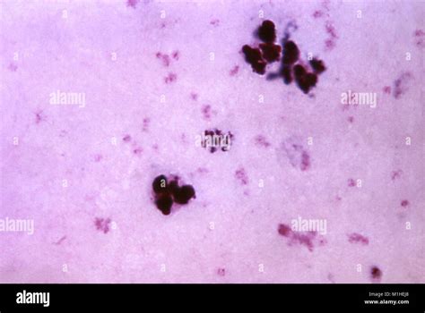Photomicrographie Du Parasite Du Paludisme Plasmodium Malariae Dans Sa