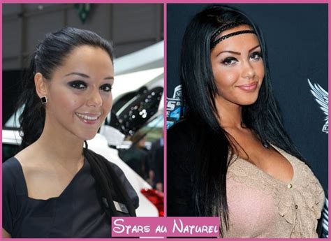 Selon le journaliste, nabilla serait en fait une dame de 55 ans, femme d'un banquier de chez rothschild, qui aurait consacré plus de 5 millions. Stars au naturel: Nabilla Benattia et la chirurgie esthétique