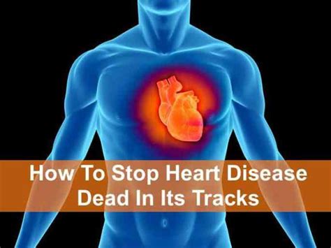How To Stop Heart Disease Dead In Its Tracks Garma On Health