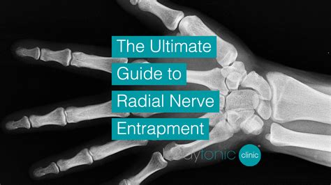 The Ultimate Guide To Radial Nerve Entrapment Causes And Prevention
