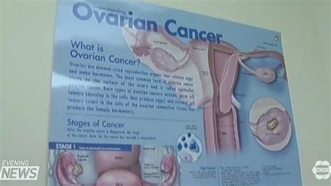 Ovarian Cancer Test Chch