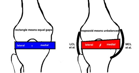 Gap Balance Soft Tissue Tension — Hip And Knee Book