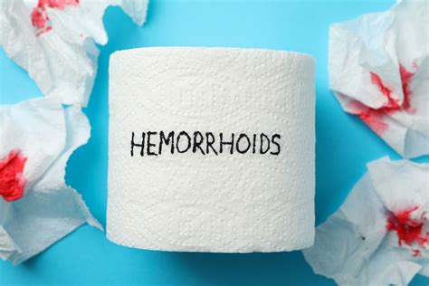 Why Do Hemorrhoids Bleed For Many Weeks Gastrointestinal Disorders