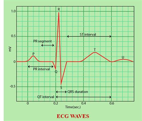 อัลบั้ม 91 ภาพ Ekg 1 ช่องเล็ก คมชัด