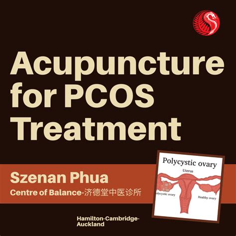 Acupuncture For Pcos Best Acupuncture Hamilton Nz