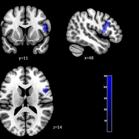Group Differences Yielded For Reward Consumption Neural Activation Pfwe Download Scientific