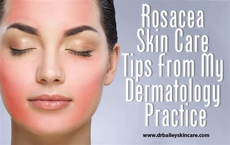 Rosacea Skin Care Tips From My Dermatology Practice Rosacea Skin Care