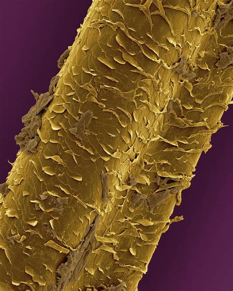 Human Eyelash Hair Photograph By Dennis Kunkel Microscopyscience Photo