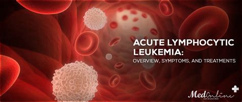 Acute Lymphocytic Leukemia Overview Symptoms And Treatments Online