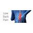 What Is Lower Back Pain  Doctor