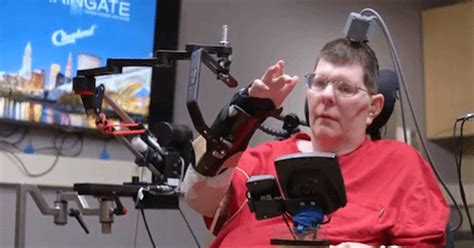 Brain Implants Allow A Quadriplegic To Move Arm Just By Thinking
