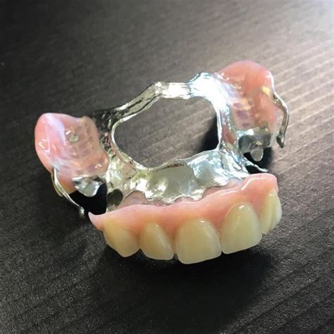 Acrylic And Metal Partial Dentures Denture Care Services