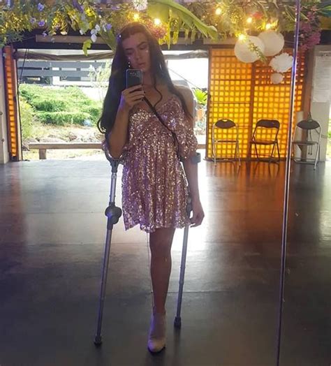 The Most Beuatiful Shd Hip Amputee One Legged Girl With Crutches