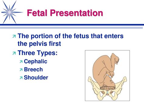 Fetal Presentation Types