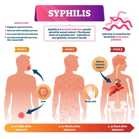 Syphilis In Men