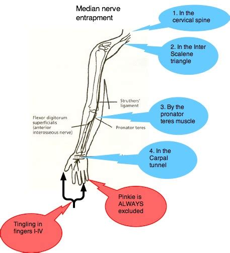 Median Nerve Entrapment Sites Fit For Life Wellness Clinic