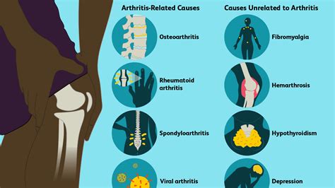 Physical Therapy For Arthritis Arthritis Treatment In Dubai