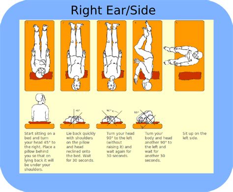 Invented by otolaryngologist, matthew bromwich md, the dizzyfix is a visual guidance. Right Sided BPPV Treatment | Physical Therapy | Pinterest ...