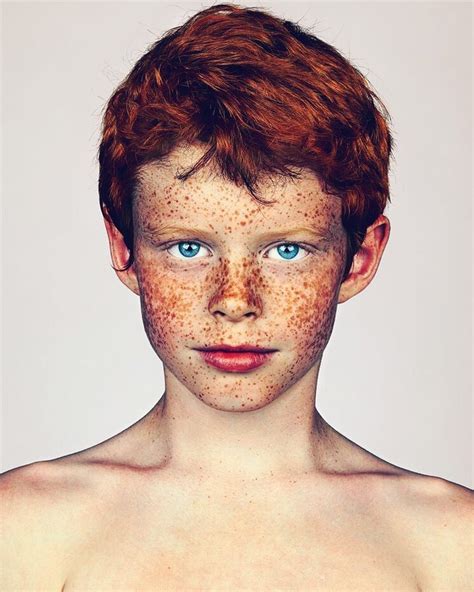 Lond Based Photographer Captures Gorgeous Photos Of Freckled People To