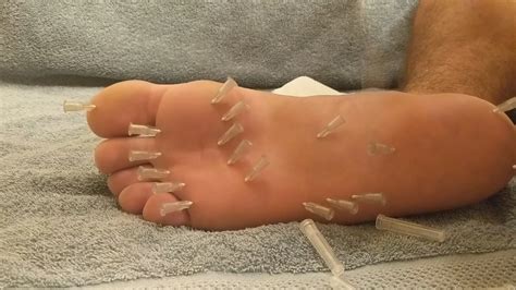 More Needles In Feet