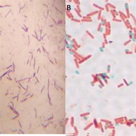 A Strain G9 Grams Staining Gram Positive Rod Shaped Bacteria