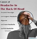 Pictures of Ice Pick Migraine Treatment