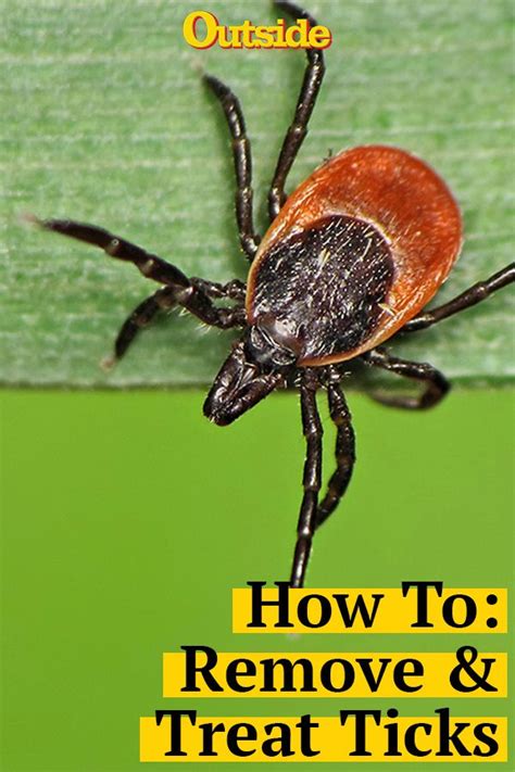 Are You Ready For Ticks This Summer Ticks Seed Ticks Tick Removal