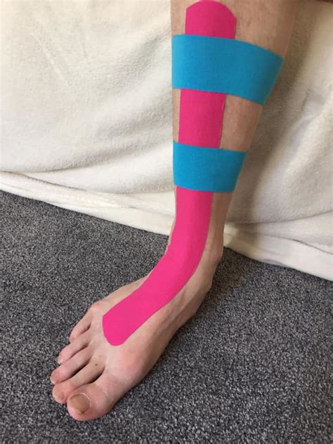How To Use Kinesiology Tape For Shin Splints