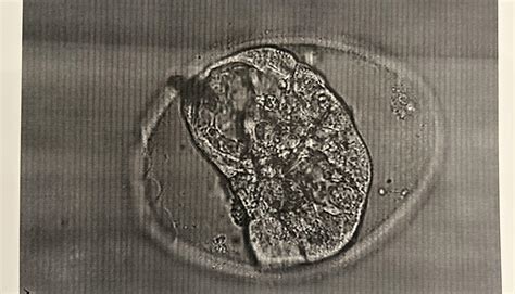 I would appreciate any feedback on my embryo, especially how it’s egg