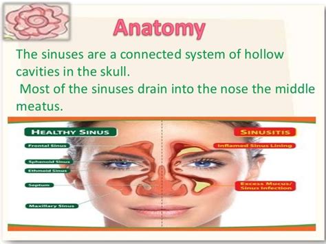 Fungal Sinusitis