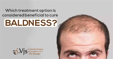 Which Treatment Option Is Considered Beneficial To Cure Baldness