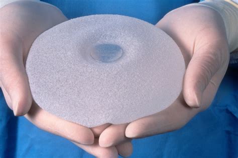 Textured Breast Implants Linked To 9 Deaths From Rare Cancer Medical Design And Outsourcing