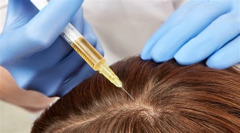 The Most Effective Hair Loss Treatments And How To Use Them Vera Clinic