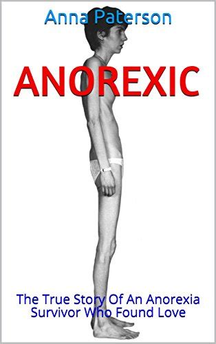 anorexic the true story of an anorexia survivor who found love english edition ebook