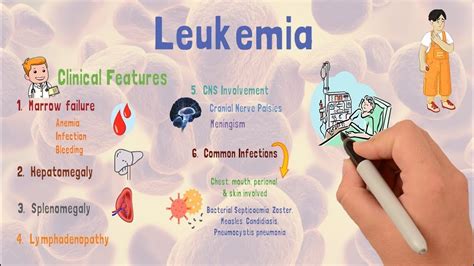 Leukemia Causes Types Early Signs Treatment YouTube