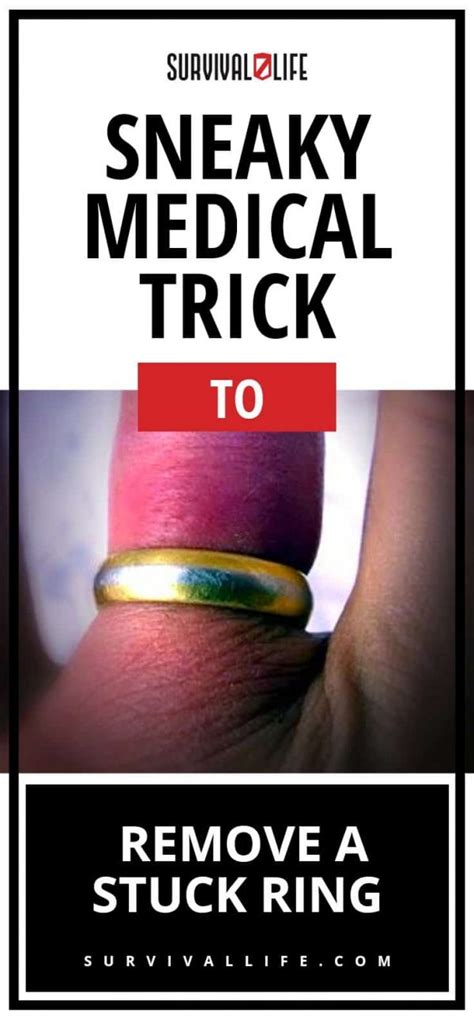 Sneaky Medical Trick To Remove A Stuck Ring Survival Life