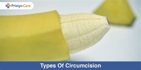 Types Of Circumcision
