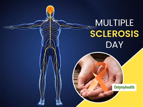 Prevalence of multiple sclerosis in the middle black sea region of turkey and demographic characteristics of patients. World Multiple Sclerosis Day 2020: Everything About This ...