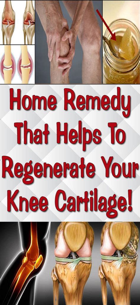 Pin By Erickson On Food Healthy Food Home Remedies For Arthritis Knee Cartilage Repair Remedies