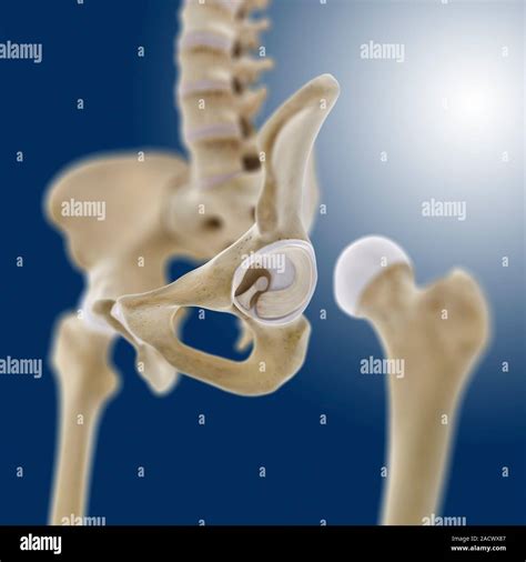 Hip Socket Anatomy Artwork Of An Oblique View Of The Bones And