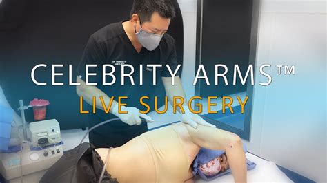 Arm Liposuction Live Surgery Immediate Results Celebrity Arms