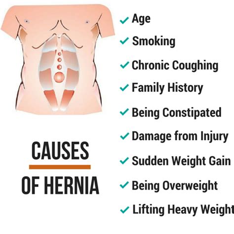 All You Need To Know About Your Hernia Surgery