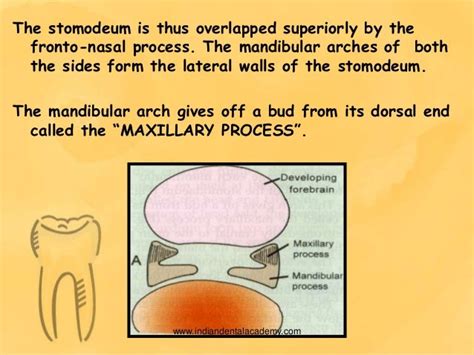 Development Of Maxilla And Mandibleprosthodontic Courses