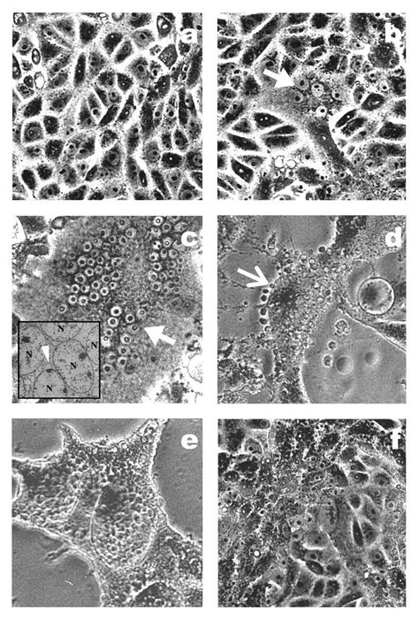 Throughout the history of the world humans have been plagued by diseases of various types and origins. Quantitative estimation of Nipah virus replication ...