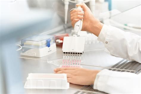Nuestro compuesto exclusivo y patentado, ha demostrado en sus estudios la reducción de manchas de. ANTI-PIGMENT von EUCERIN: die Linie gegen Pigmentflecken