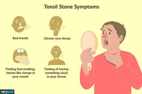 Bad Breath Caused By Tonsils Nodules Throat Sore Thyroid Chronic