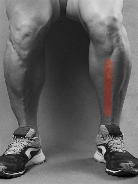 Most Common Running Injury The Shin Splints Lower Limb Specialist