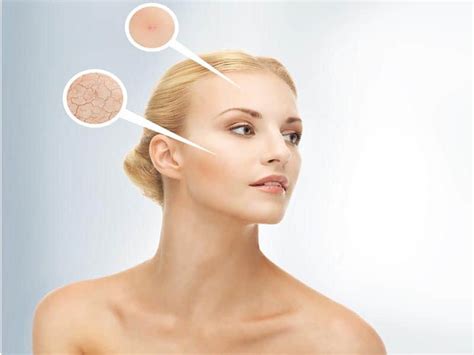 Main Causes Of Dry Skin And How To Prevent It Styles At Life