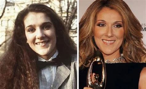 Celine Dion Before And After Plastic Surgery Face Nose Teeth
