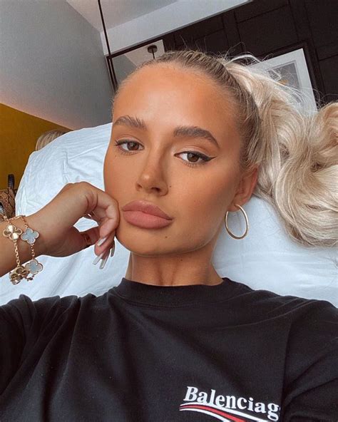 Molly Mae Hague Unveils Natural Lips For First Time As She Gets Fillers Removed Irish Mirror